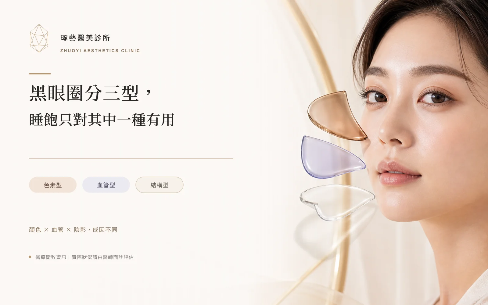 黑眼圈分三型,睡飽只對其中一種有用