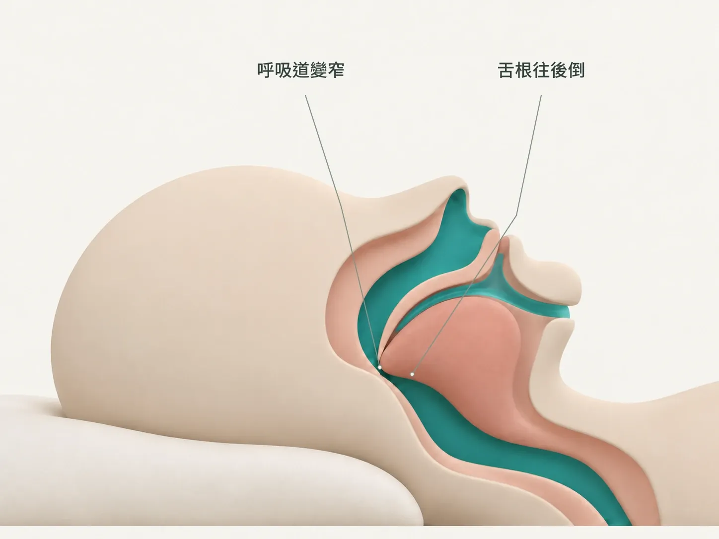 示意圖:平躺時舌根往後倒,把呼吸道擠窄
