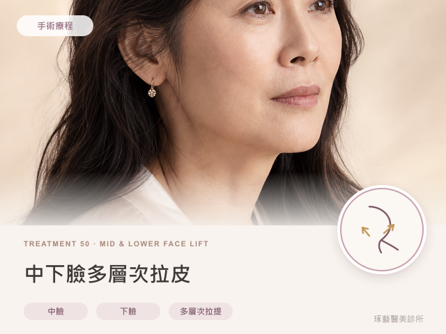 中下臉多層次拉皮｜桃園醫美 琢藝美學診所